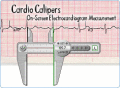 On-screen electrocardiogram measurement.