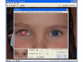 Red eye removal and general photo editing